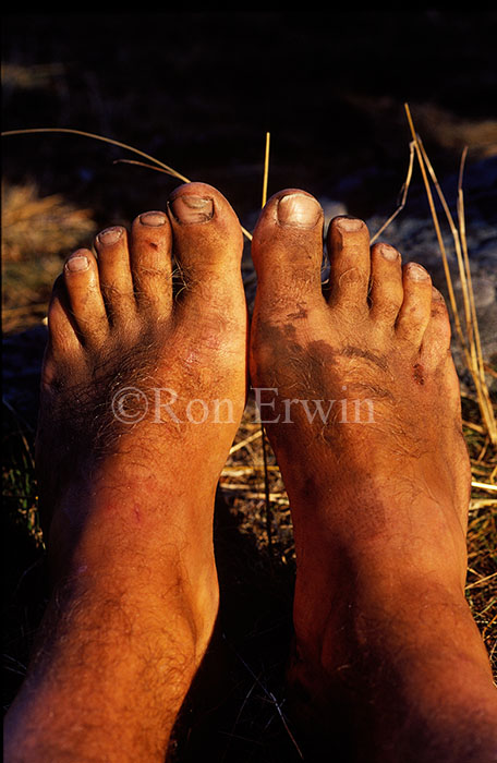 Dirty Feet